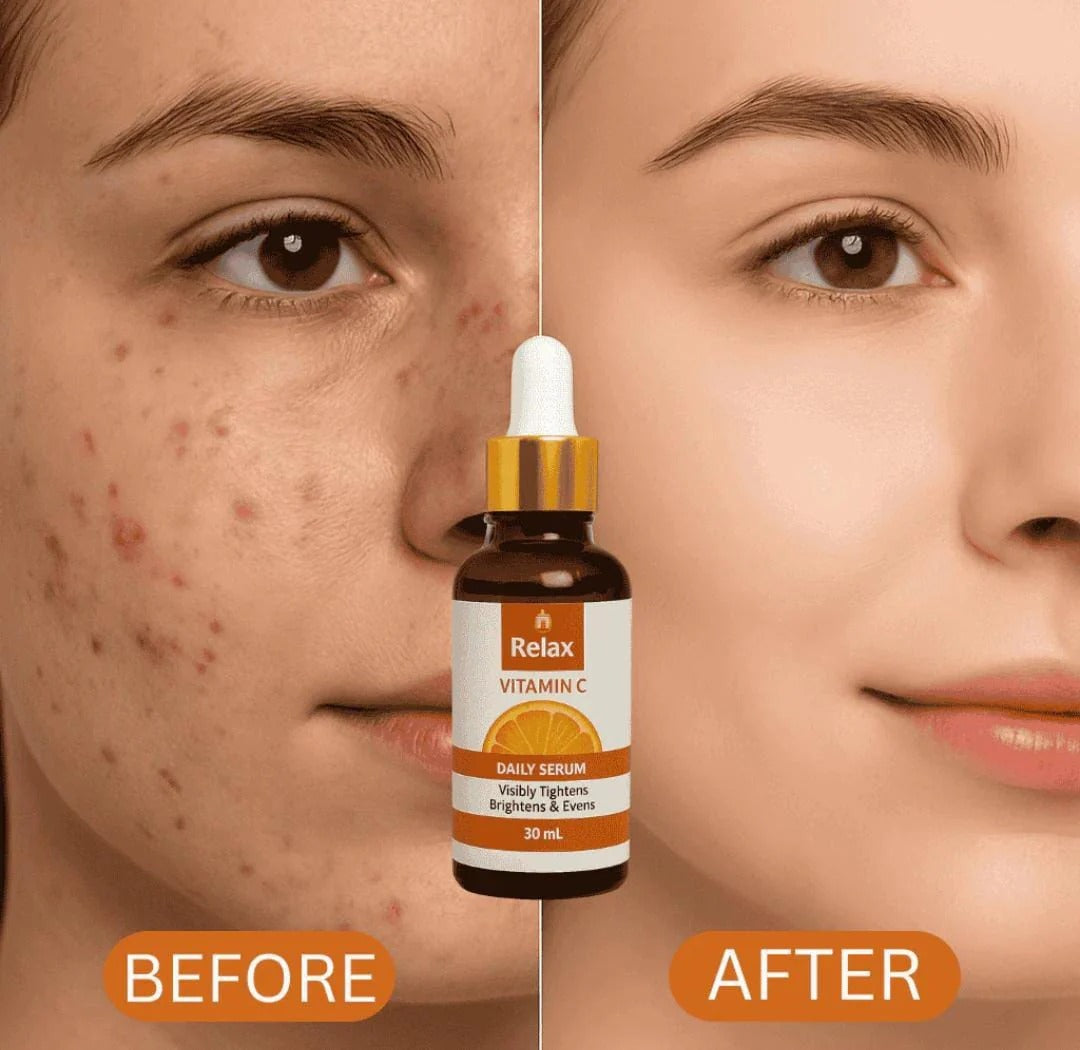 Relax Vitamin C Serum – Brightening, Anti-Aging & Glowing Skin Care (30ml)