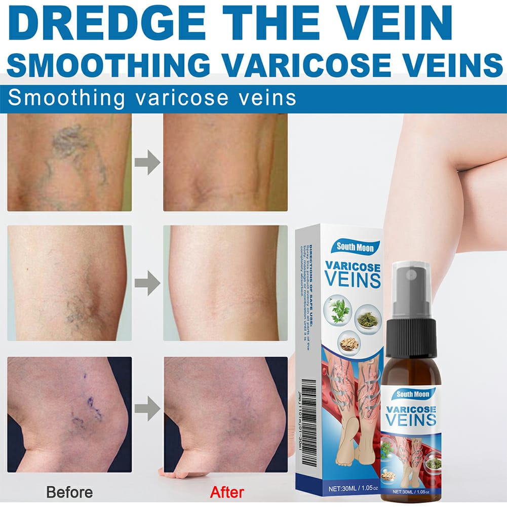 Vein Therapy Spray – Reduce Swelling & Pain Fast
